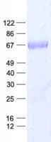 Human IOP1 / NARFL Protein (Recombinant His, N-Terminal)