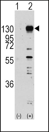 FGFR1 / FGF Receptor 1 Antibody (Tyr653)
