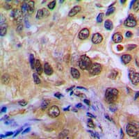 POTEA / POTE8 Antibody (C-Terminus)