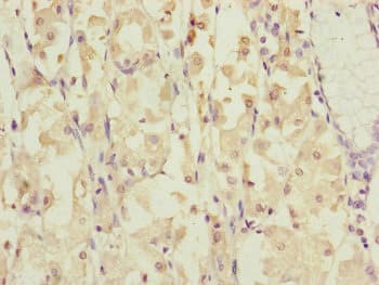 Polyclonal Rabbit anti-Human DYNC1I1 Antibody (IHC, WB)
