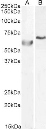 IHC-plus™ Polyclonal Goat anti-Human POLL / DNA Polymerase Lambda Antibody (aa563-575, IHC, WB)