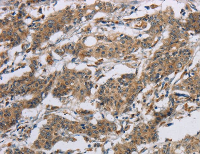 Polyclonal Rabbit anti-Human SYN2 / Synapsin II Antibody (IHC, WB)