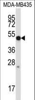 IHC-plus™ Polyclonal Rabbit anti-Human MMP28 Antibody (aa195-223, IHC, WB)