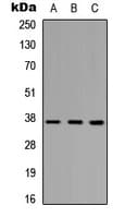 Polyclonal Rabbit anti-Human PINX1 Antibody (Internal, IHC, WB)