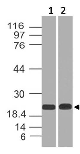 CBX5 / HP1 Alpha Antibody