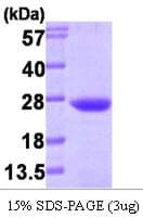 Human VPS28 Protein (Recombinant)