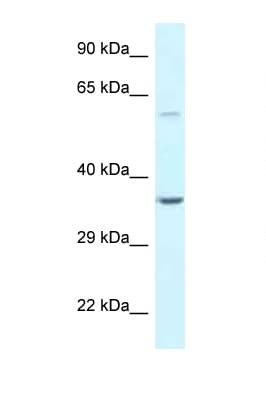 Polyclonal Rabbit anti-Human BAG5 Antibody (aa74-123, WB)