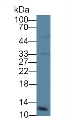CTSC / Cathepsin C / JP Antibody (aa231-463)