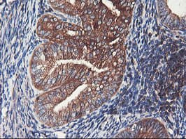 PFKP Antibody (clone OTI2E10)