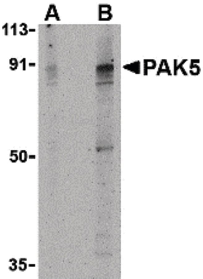 IHC-plus™ Polyclonal Rabbit anti-Human PAK7/PAK5 Antibody (IHC, IF, WB)