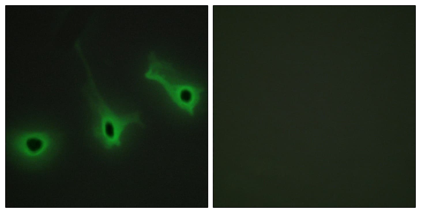 Polyclonal Rabbit anti-Human COL5A3 / Collagen V Alpha 3 Antibody (aa221-270, IHC, IF)