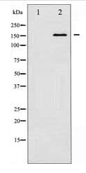 GRIN2B / NMDAR2B / NR2B Antibody