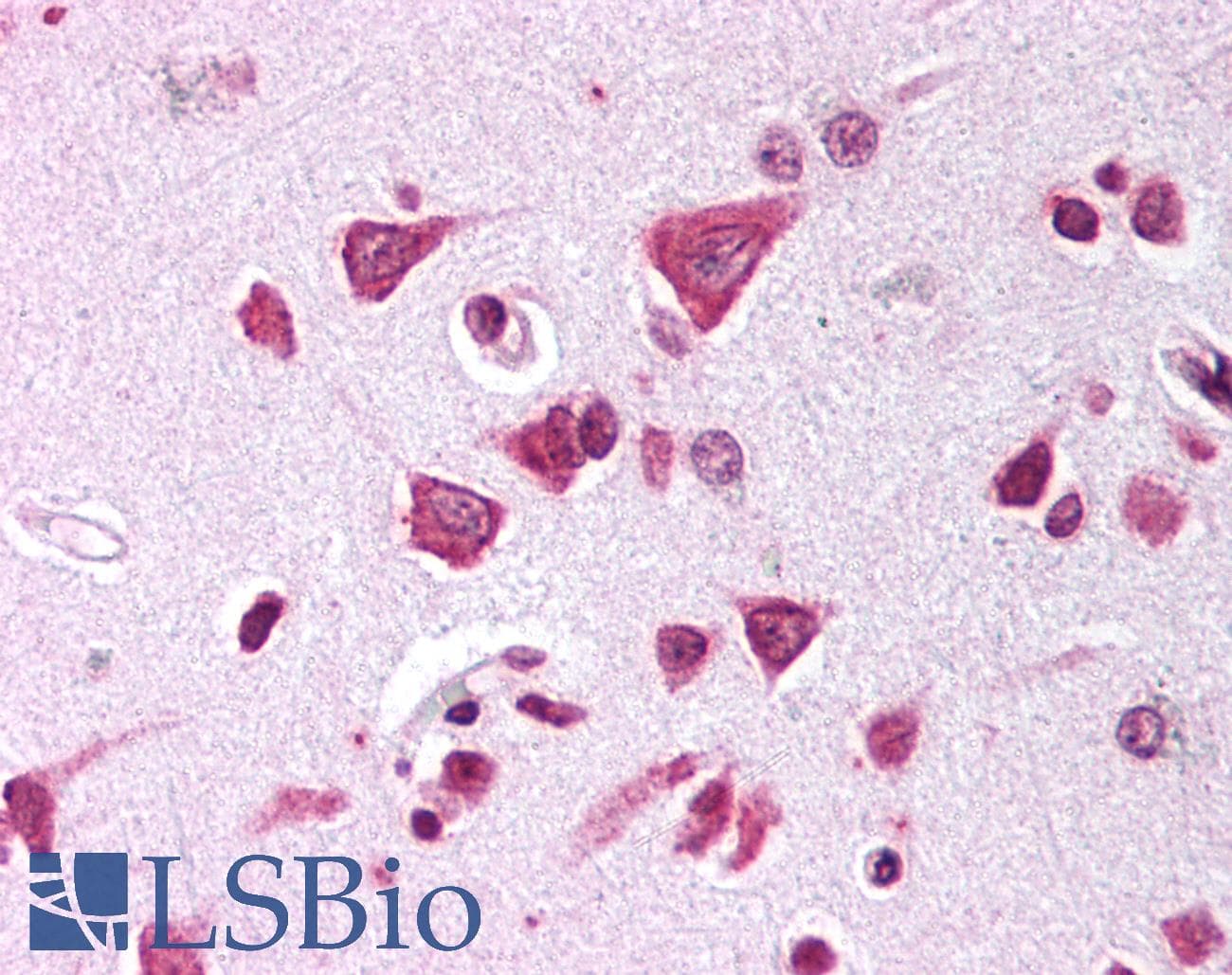 IHC-plus™ FE65L1 / APBB2 Antibody (aa315-330)