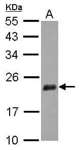 NUDT3 Antibody