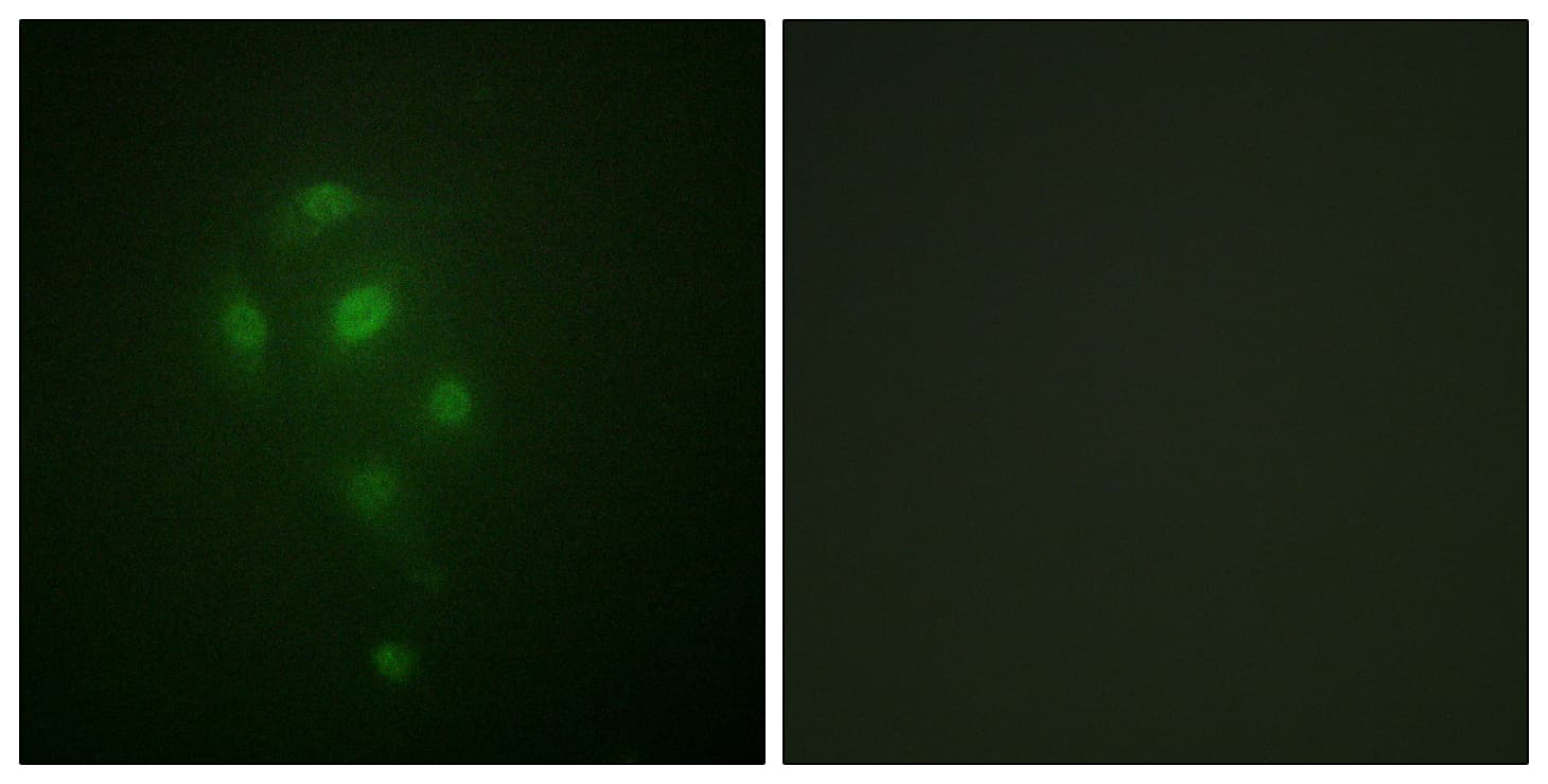 RPS6KA5 / MSK1 Antibody (phospho-Thr581)