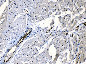 Polyclonal Rabbit anti-Human ANGPTL2 / ARP2 Antibody (IHC, WB)