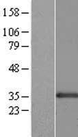 CENPK Protein (Over-Expression Lysate Myc-DDK (Flag))