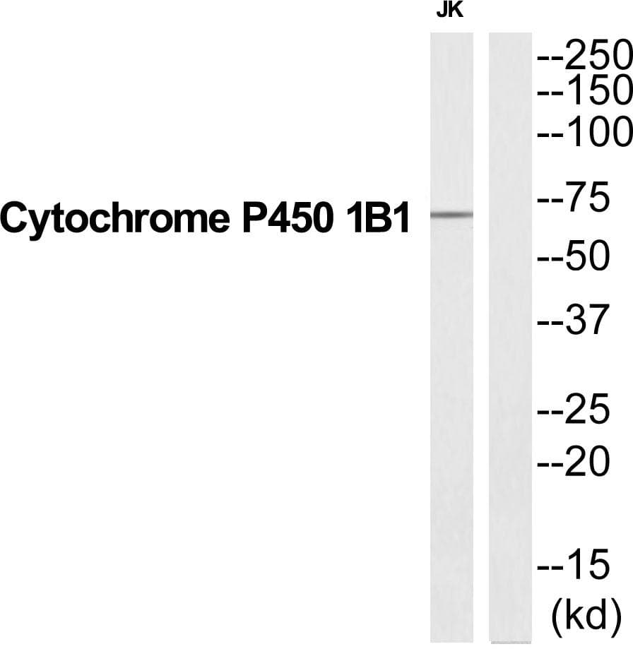 Polyclonal Rabbit anti-Human CYP1B1 Antibody (WB)