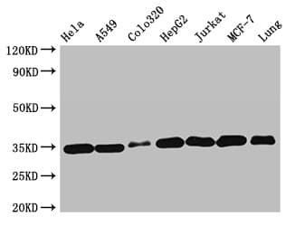 EMD / Emerin Antibody