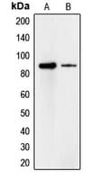 Polyclonal Rabbit anti-Human CDH18 / Ey-Cadherin Antibody (Internal, WB)