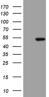 PDIA6 / ERP5 Antibody (clone OTI3E9)