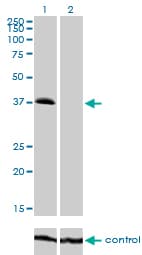TRIB2 Antibody (clone 1B1)