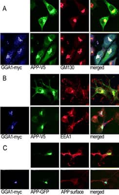 GGA1 Antibody (aa1-30)