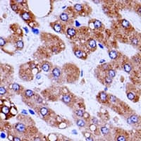 OTC Antibody