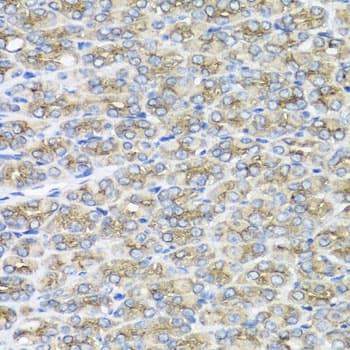 Polyclonal Rabbit anti-Human STXBP2 Antibody (IHC, IF, WB)
