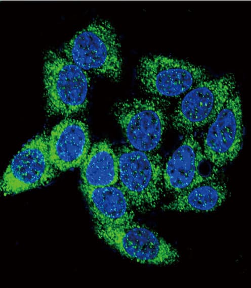 AHR Antibody (aa555-582)