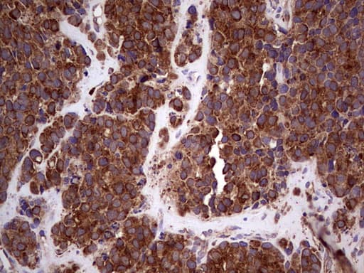 RET Antibody (aa713-1017, clone OTI21H4)