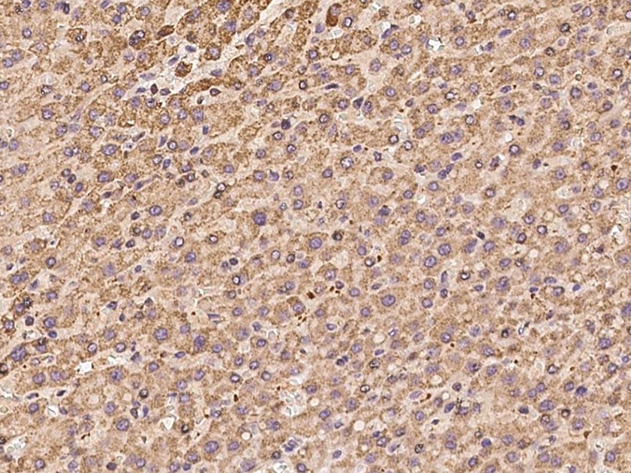 Polyclonal Rabbit anti-Human PCCB Antibody (IHC, WB)