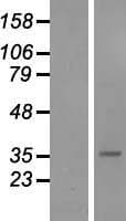 SFRP5 Protein (Over-Expression Lysate Myc-DDK (Flag))