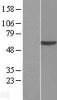 USP22 Protein (Over-Expression Lysate Myc-DDK (Flag))
