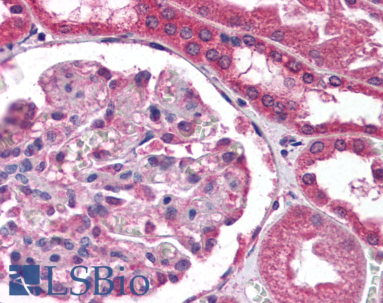 IHC-plus™ Endostatin Antibody (clone 1837.46)