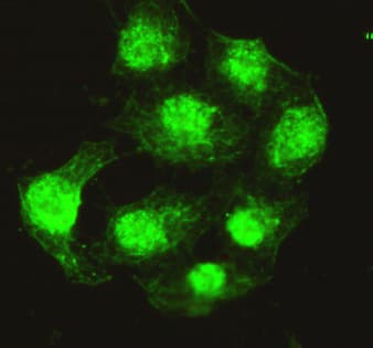 IHC-plus™ PPP4C Antibody