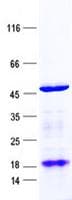 Human DAZ4 Protein (Recombinant His, N-Terminal)