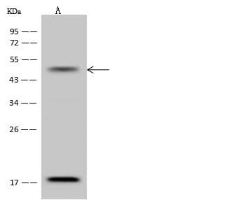 Polyclonal Rabbit anti-Human CACNB3 / Cavbeta3 Antibody (Preservative Free, WB)