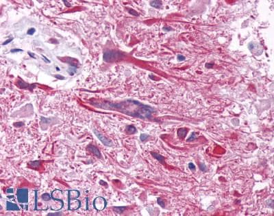 PathPlus™ GIPR / GIP Receptor Antibody (Cytoplasmic Domain)