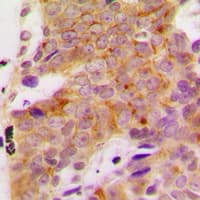 RPS6KB1 / P70S6K / S6K Antibody (phospho-Ser418)