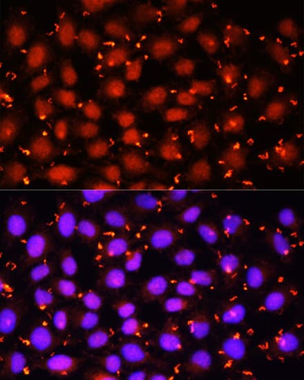 ACAA1 Antibody