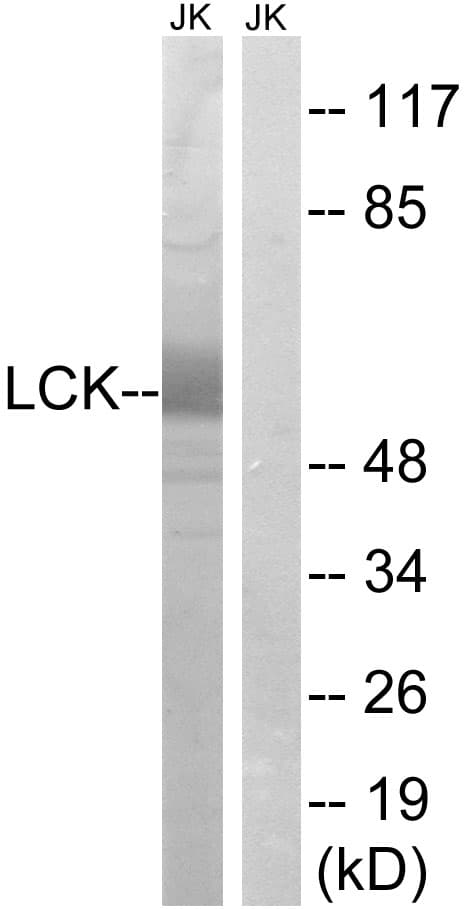 p56lck / LCK Antibody (aa26-75)