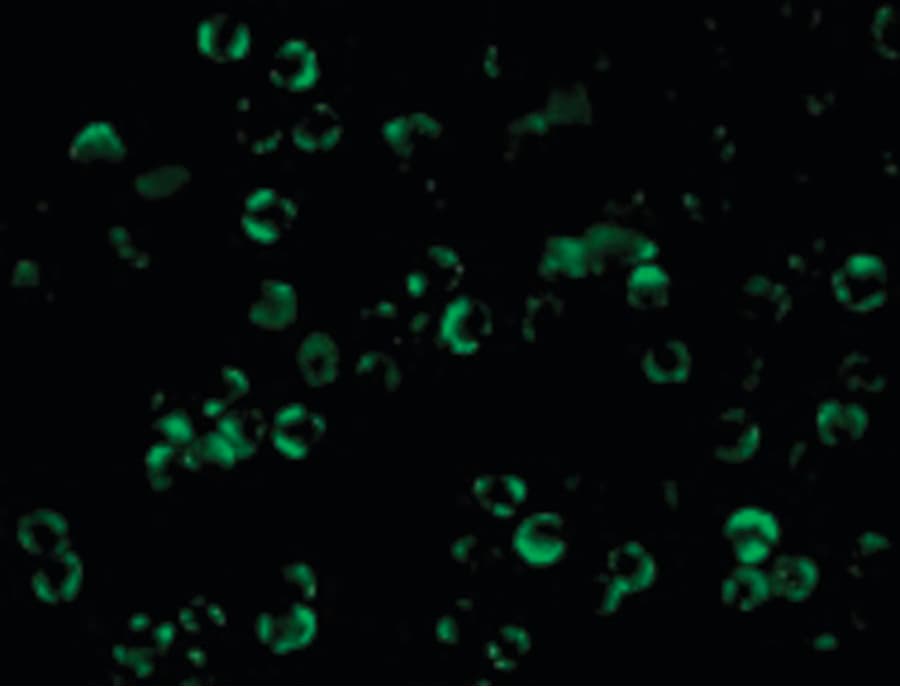 IHC-plus™ IKBKB / IKK2 / IKK Beta Antibody