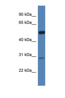IDS / Iduronate 2 Sulfatase Antibody (aa154-203)