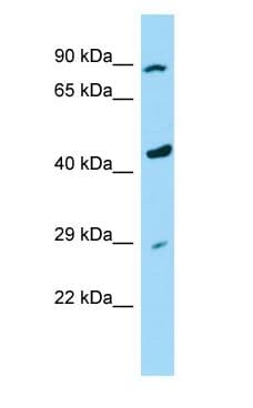 Polyclonal Rabbit anti-Human RASSF9 / P-CIP1 Antibody (aa362-411, WB)