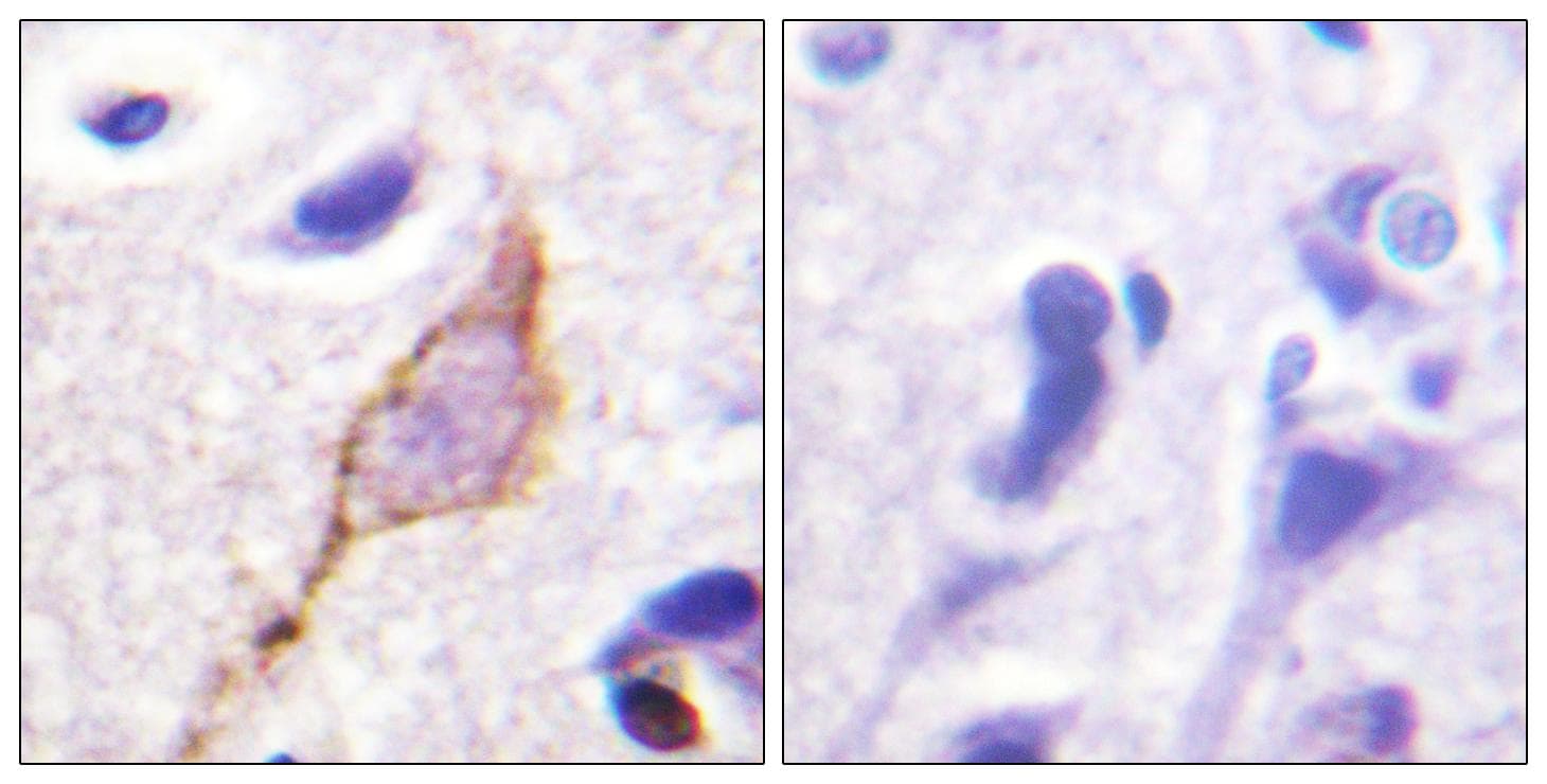 KCNQ3 Antibody (Ab-246)