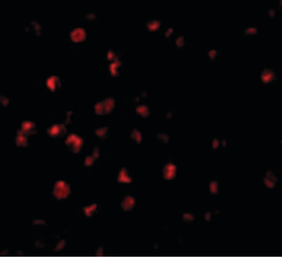 IHC-plus™ Polyclonal Rabbit anti-Human BIRC8 / ILP2 Antibody (IHC, IF, WB)