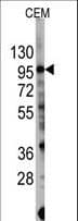 Polyclonal Rabbit anti-Human PIK3CG / PI3K Gamma Antibody (Ser1100, WB)