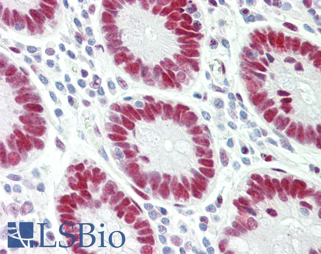 IHC-plus™ CTBP2 Antibody (aa396-445)
