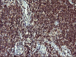 TP73 / p73 Antibody (aa167-409, clone OTI1B5)